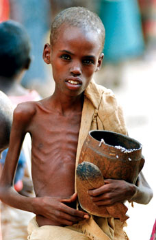 Boy holding bowl of rice and beans in Somalia.